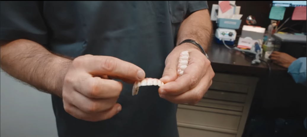 Ceramic And Porcelain Full Mouth Prosthesis