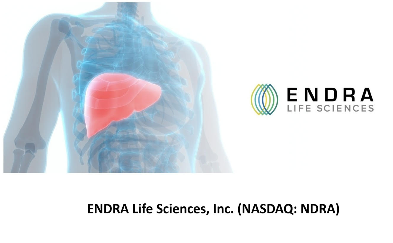 ENDRA Life Sciences (Nasdaq: NDRA) $NDRA